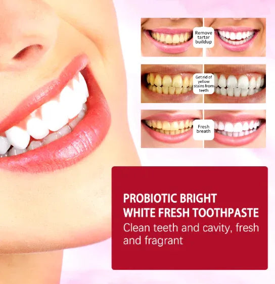 EELHOE SP-4 Teeth Whitening Toothpaste – Removes Stains & Whitens Teeth  120g